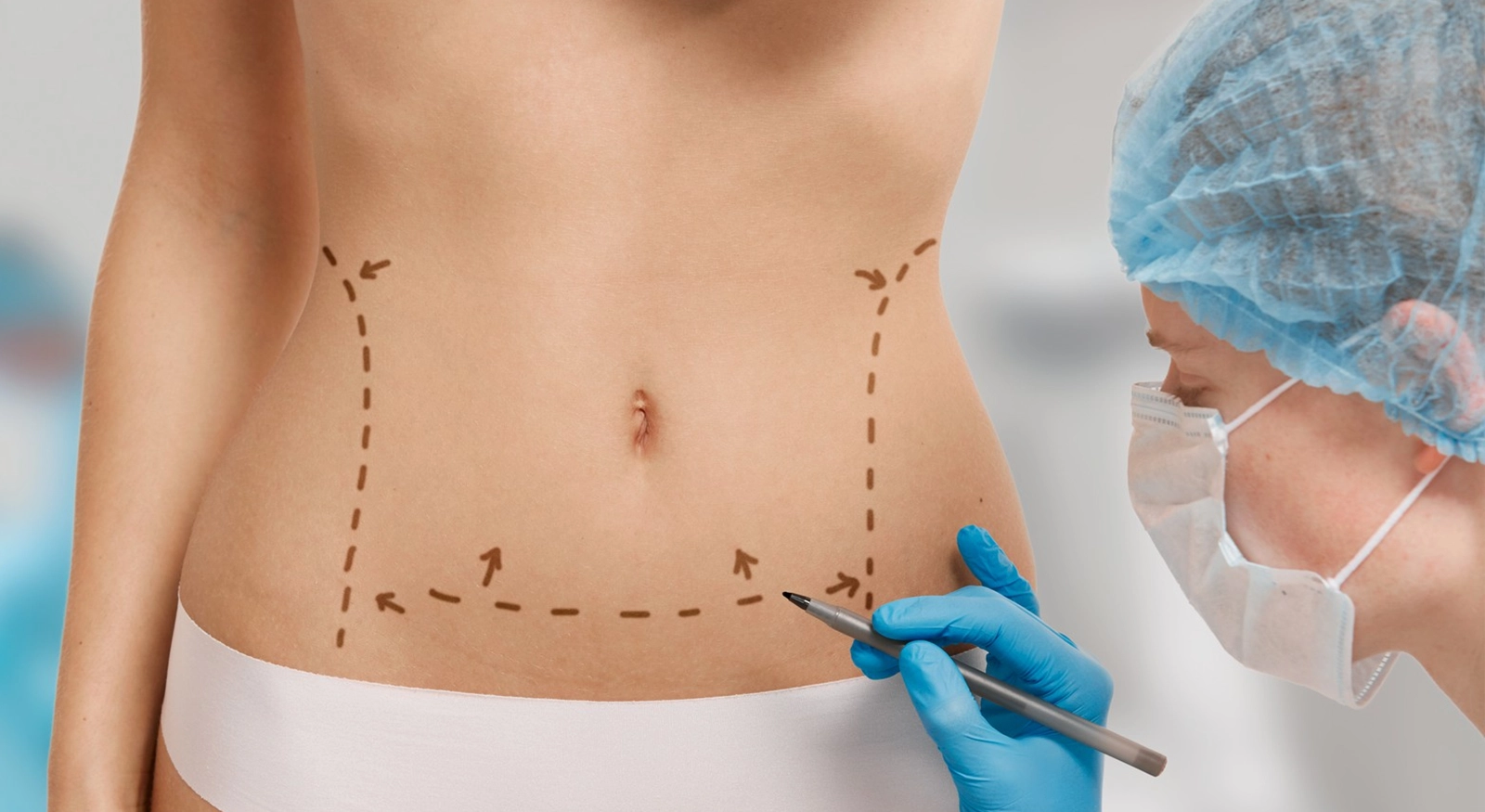 bariatric-surgery-cost-india